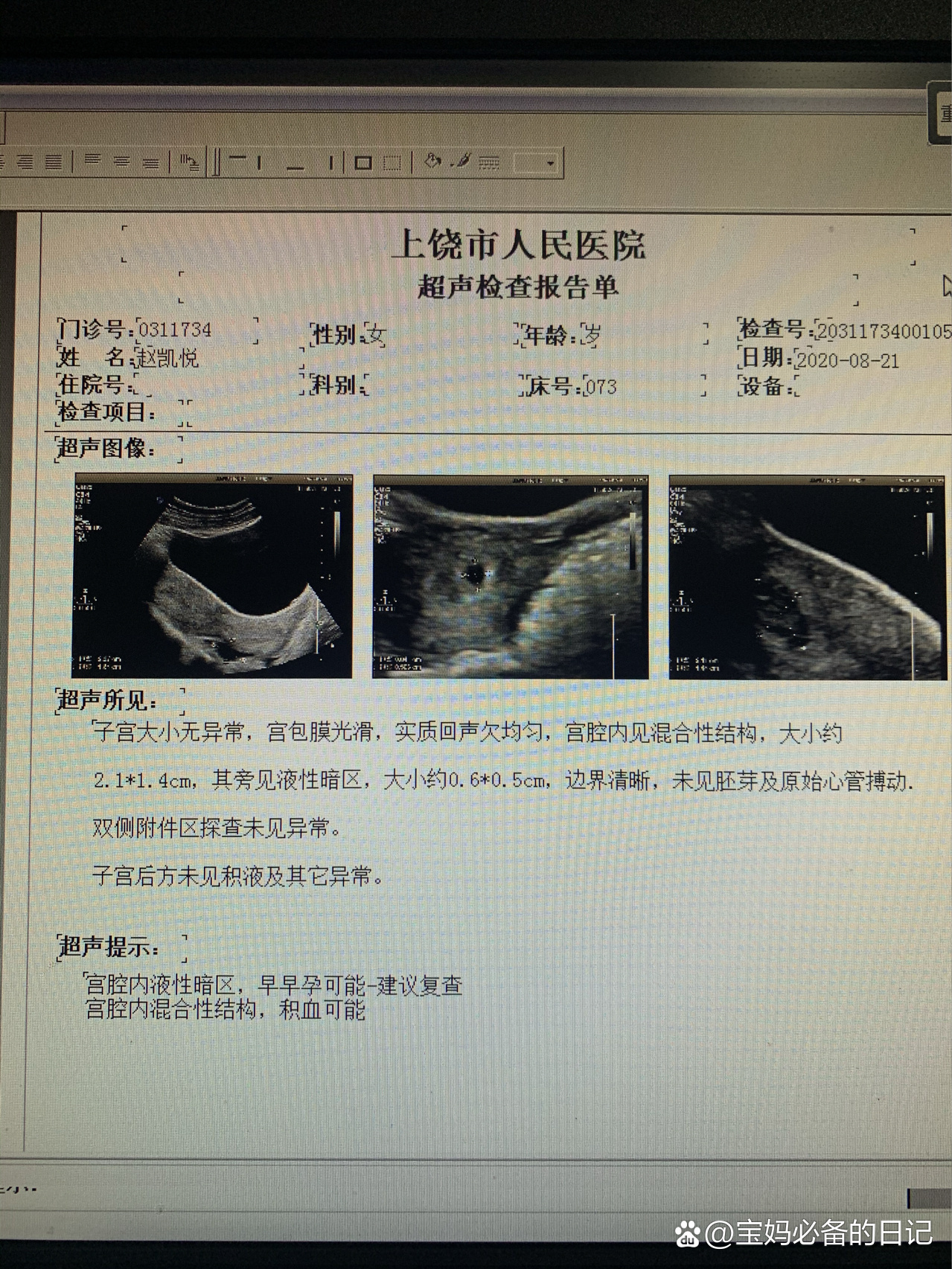 怀孕初期出血颜色表图图片