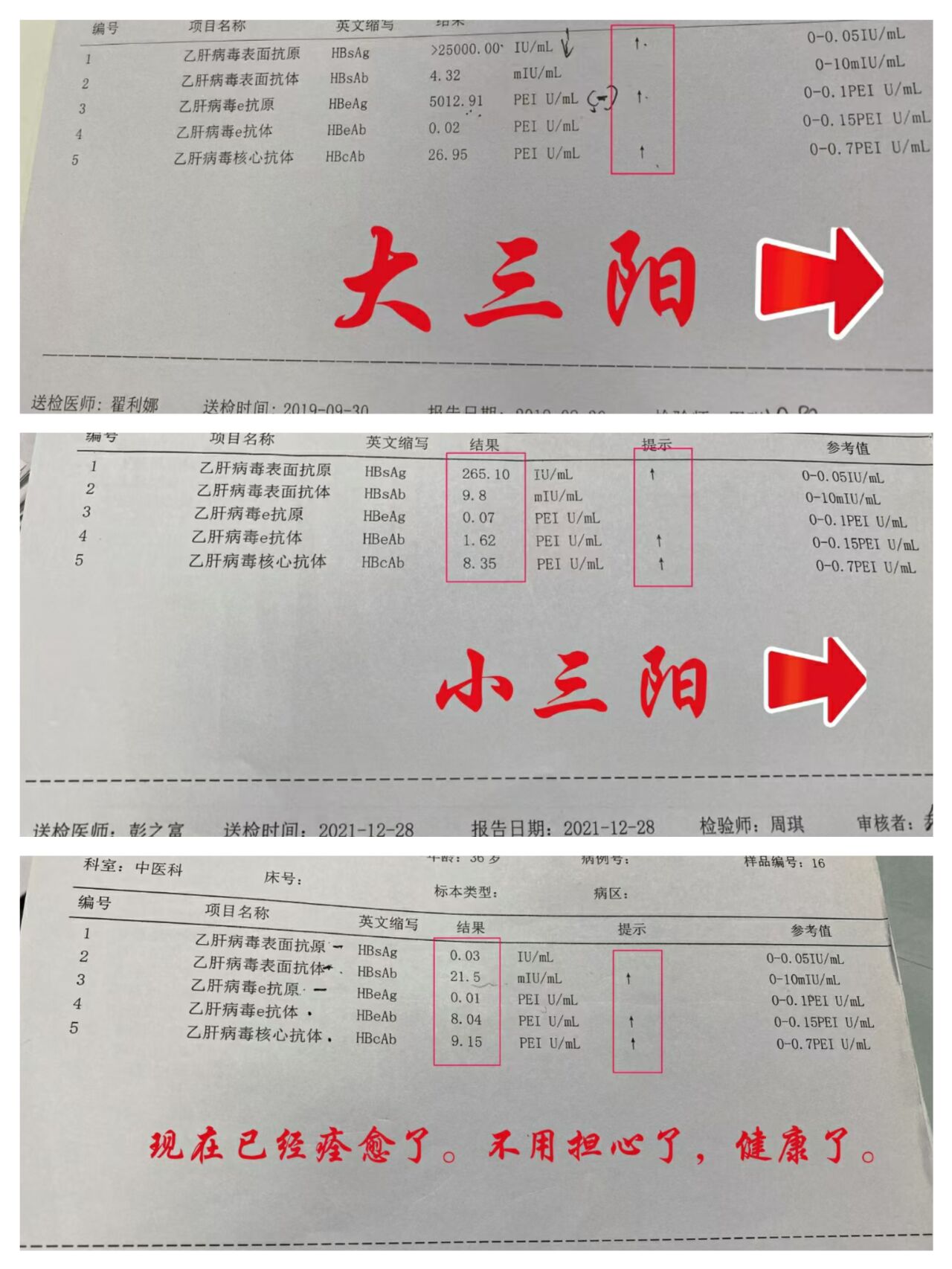 乙型肝炎大三阳图片