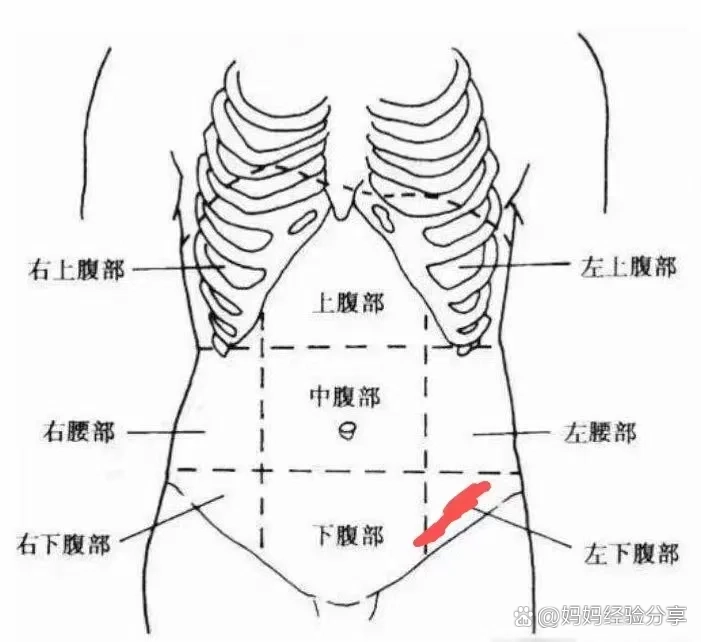 12周听胎心的位置图片图片