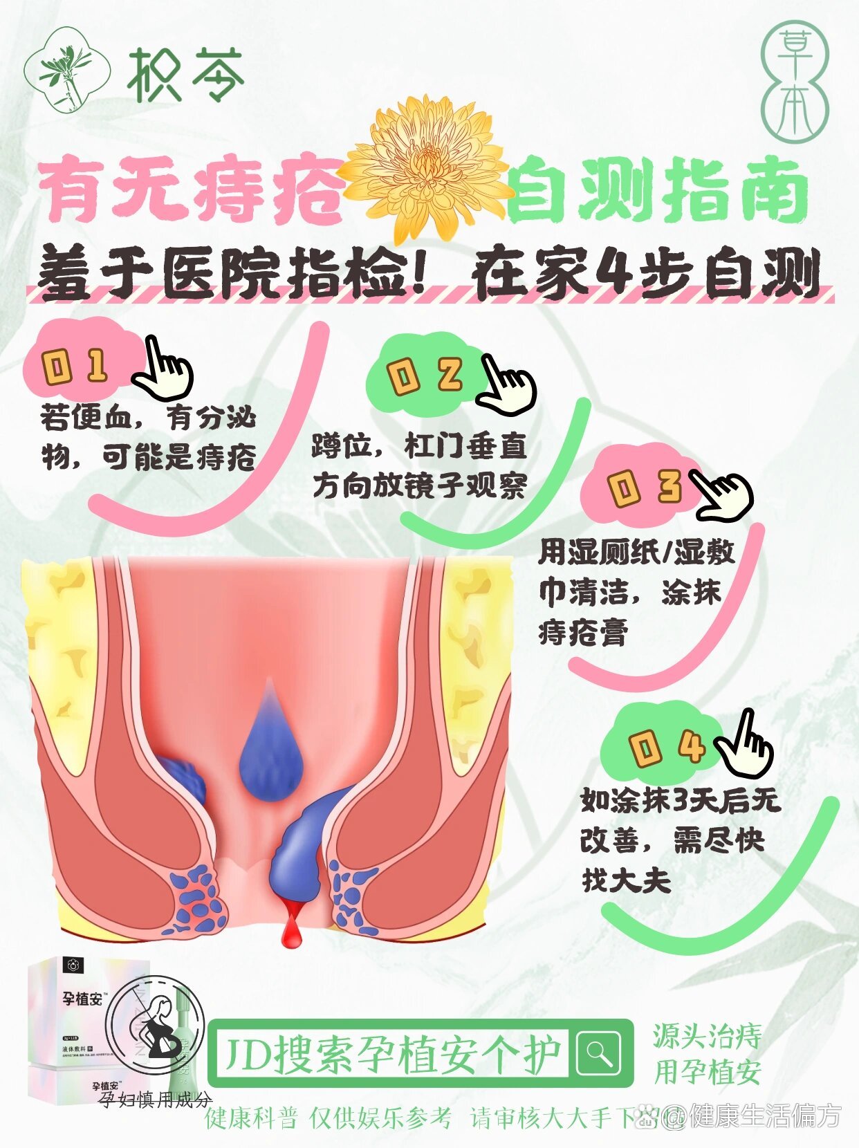 痔疮换药图解图片