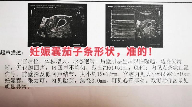 孕期B超数据看男女？