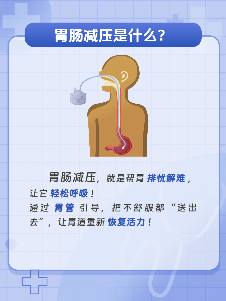 胃肠减压,一次性说清楚!