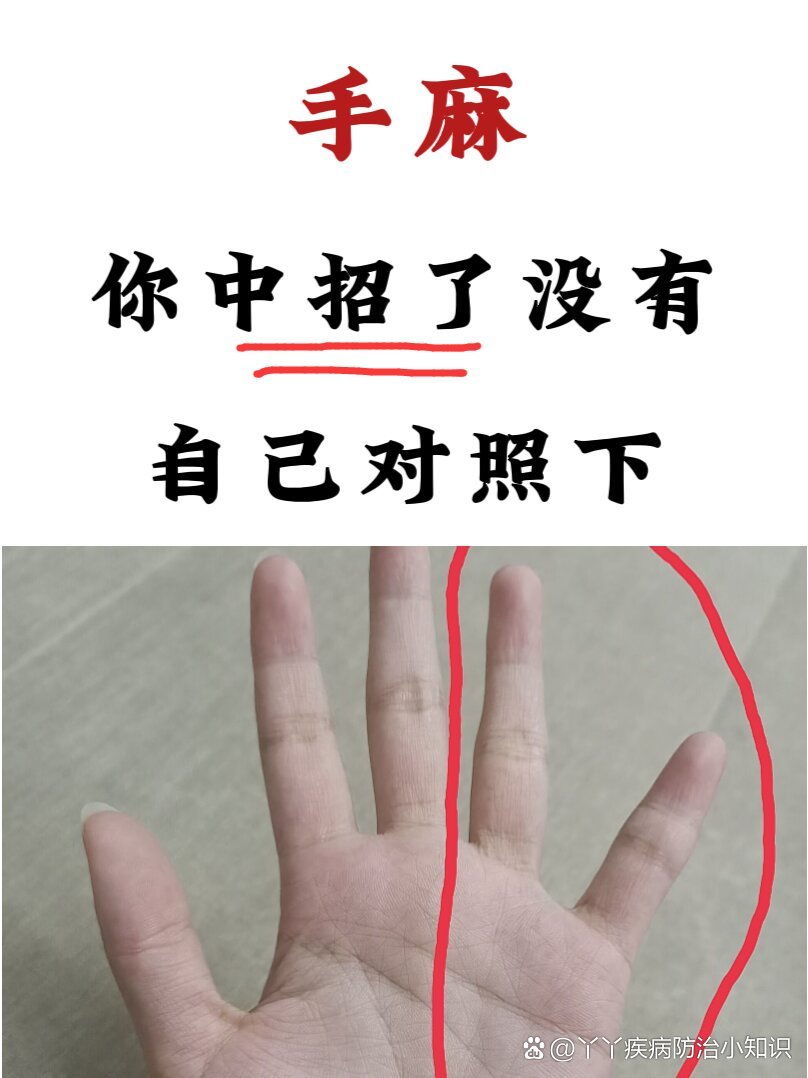 手麻为什么 手麻为什么