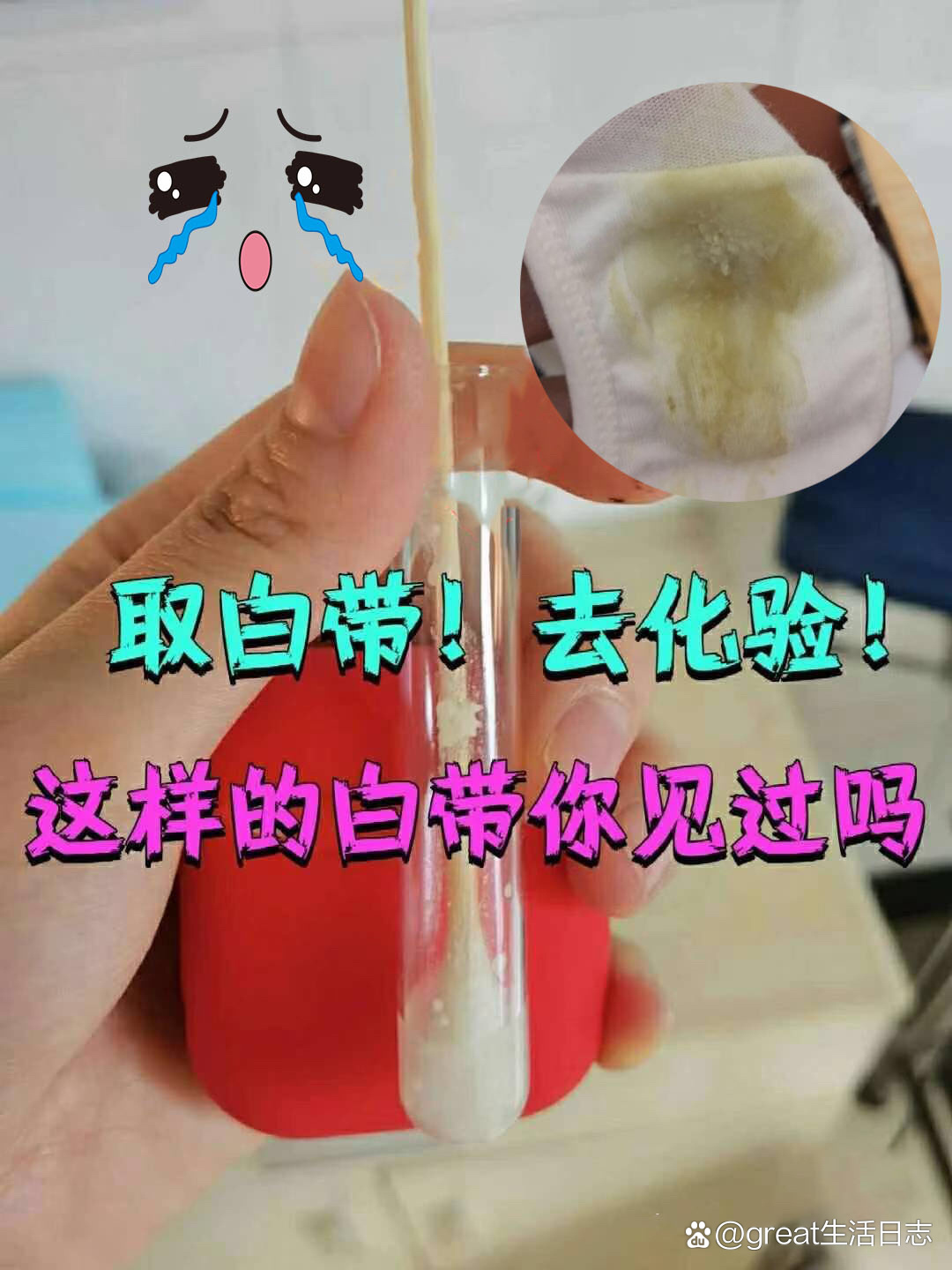 白带干的结痂的图片图片