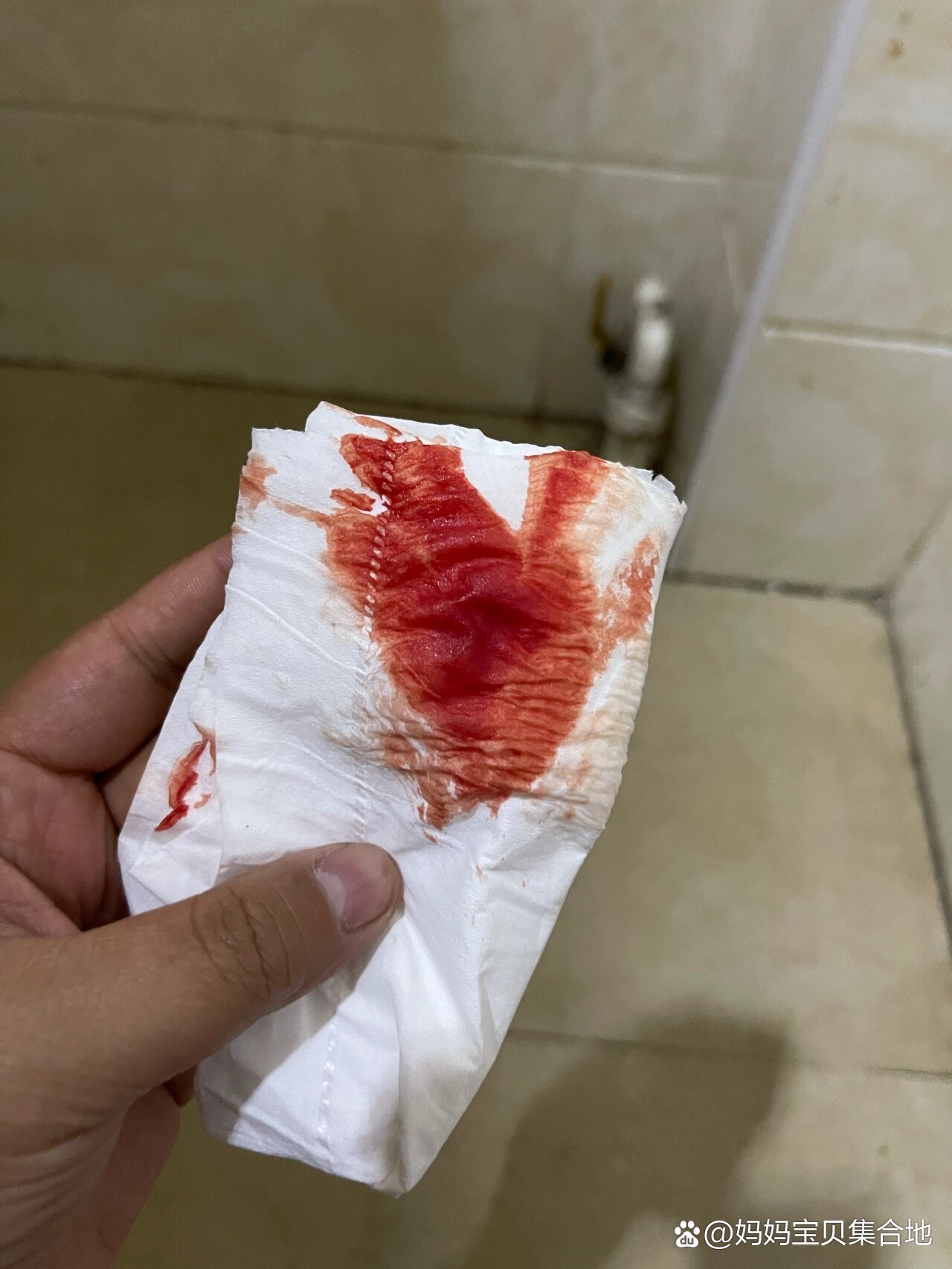 孕8周出血🩸,但是检查却正常是什么情况?