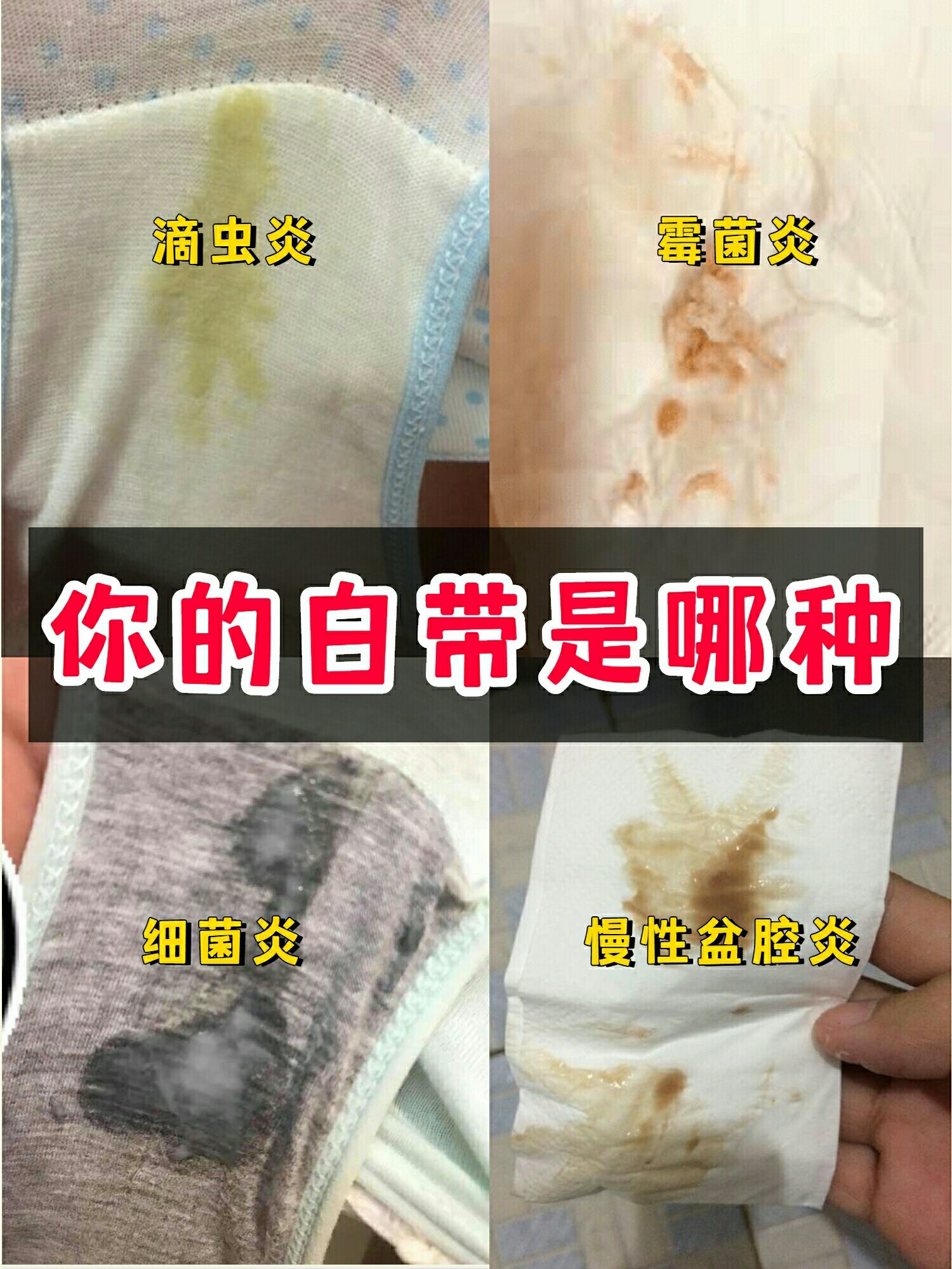 乳白色的白带图片图片