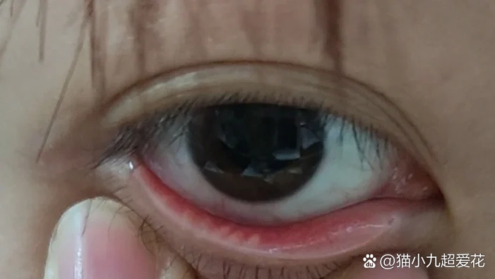  br>两只眼睛下眼睑都有好几根这种黄色线,大概零点三四厘米的长度,我