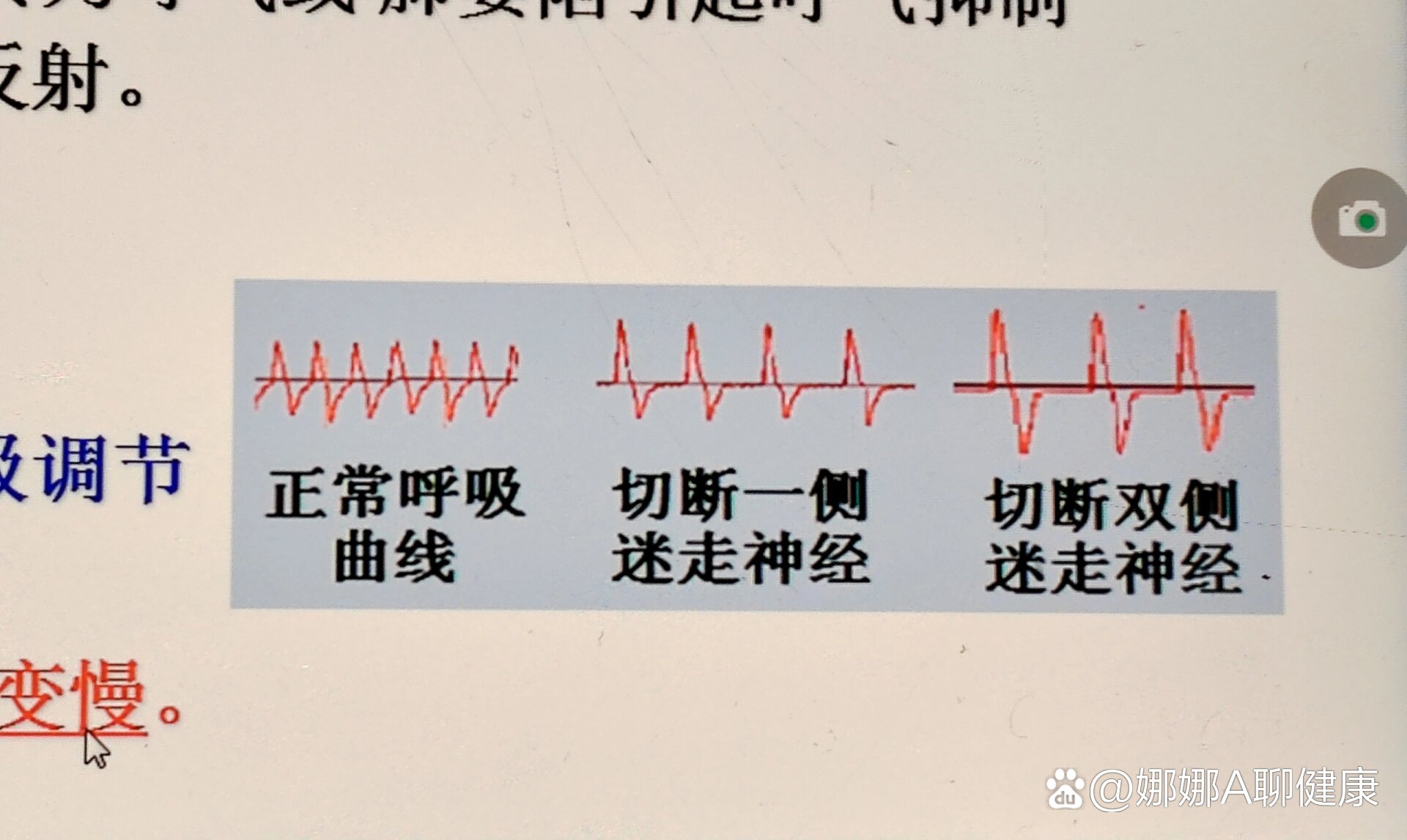 生理|剪断家兔一侧或两侧迷走神经的问题