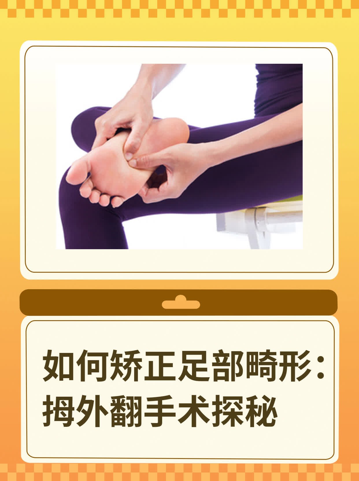 如何矫正足部畸形:拇外翻手术探秘