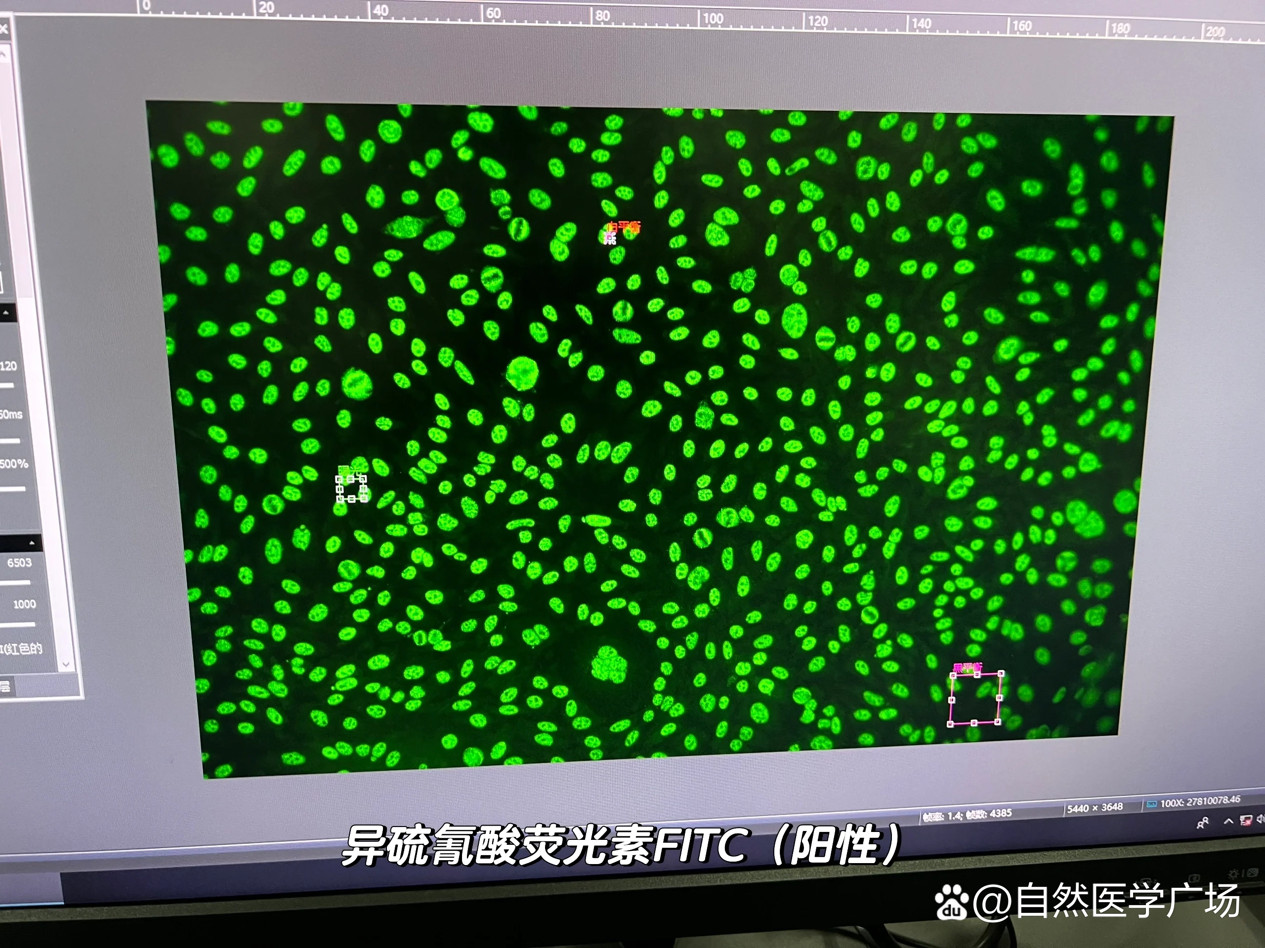 免疫荧光封闭液bsa浓度图片