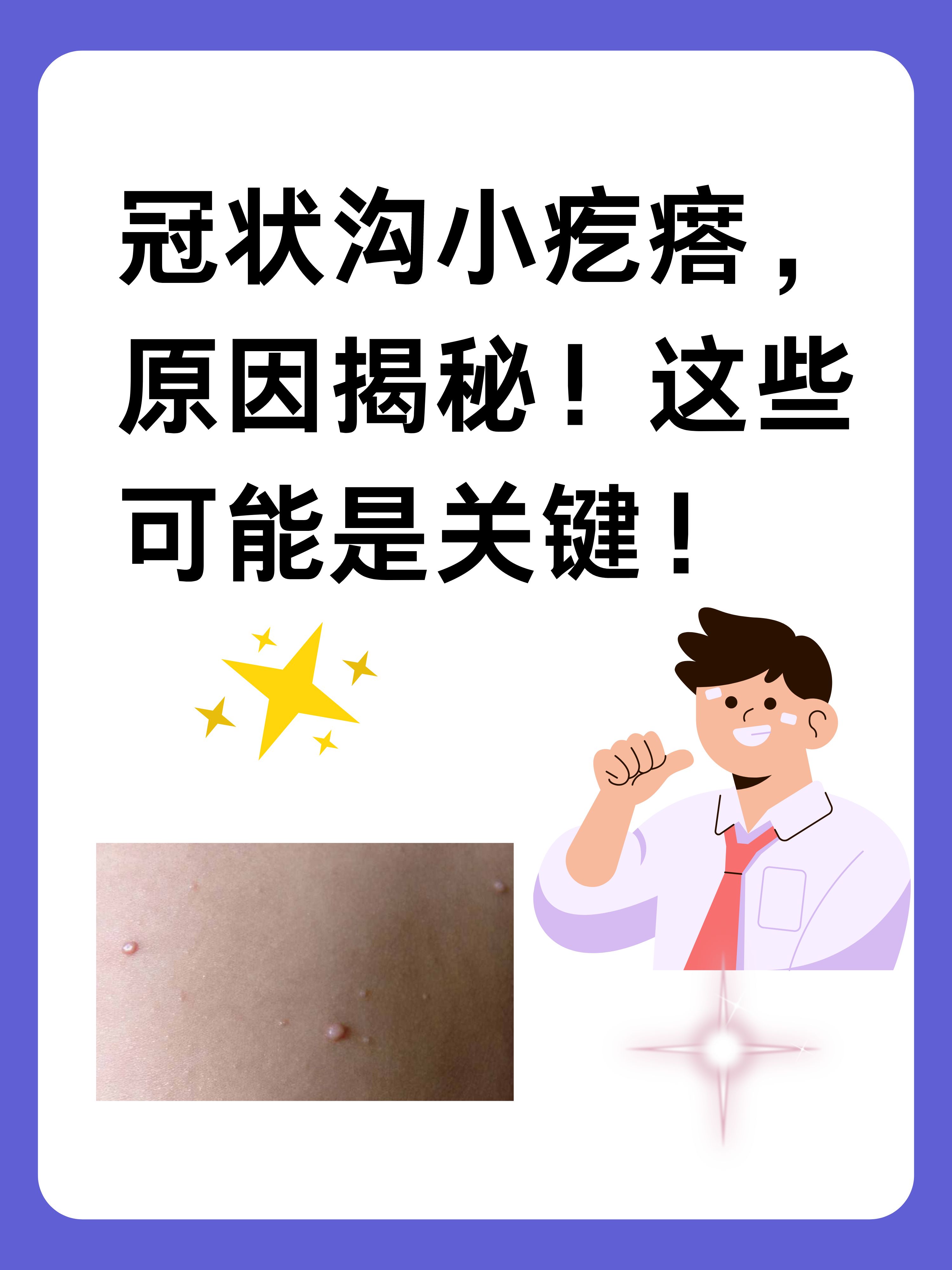 冠状沟小疙瘩,原因揭秘!这些可能是关键!
