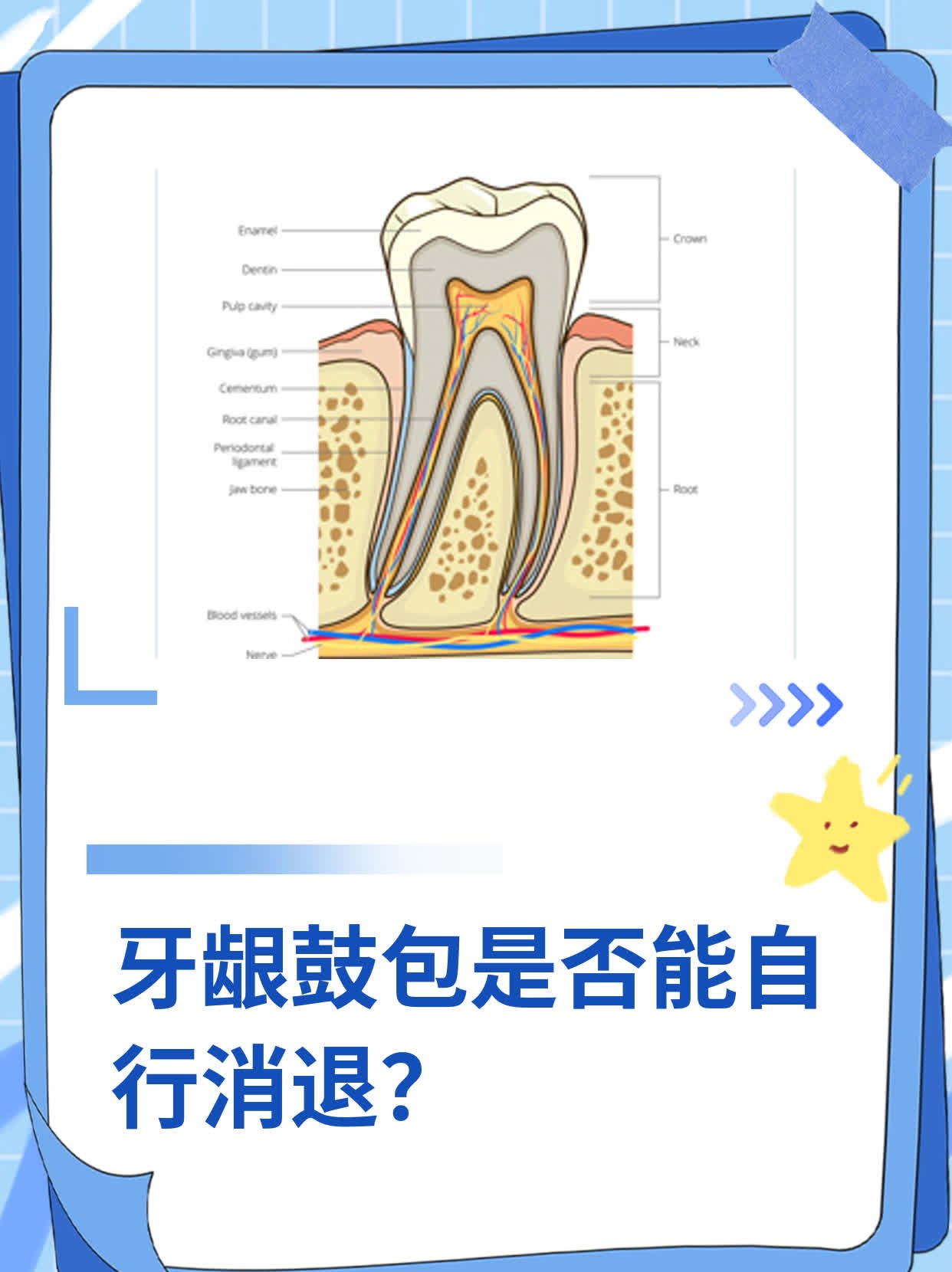 牙龈增生可以不处理吗图片