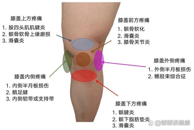 髌前滑囊炎图片