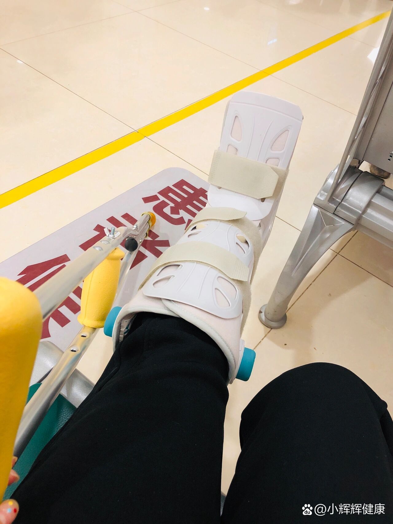 骨折一周 已经没那么痛了 恢复超快96 br>为了洗澡 把医生打的石膏