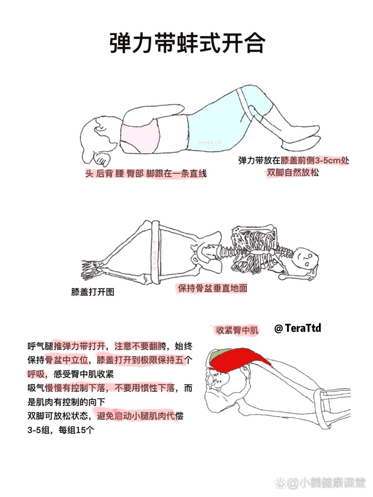 一张图带你认识x型腿|附矫正训练,弹力带