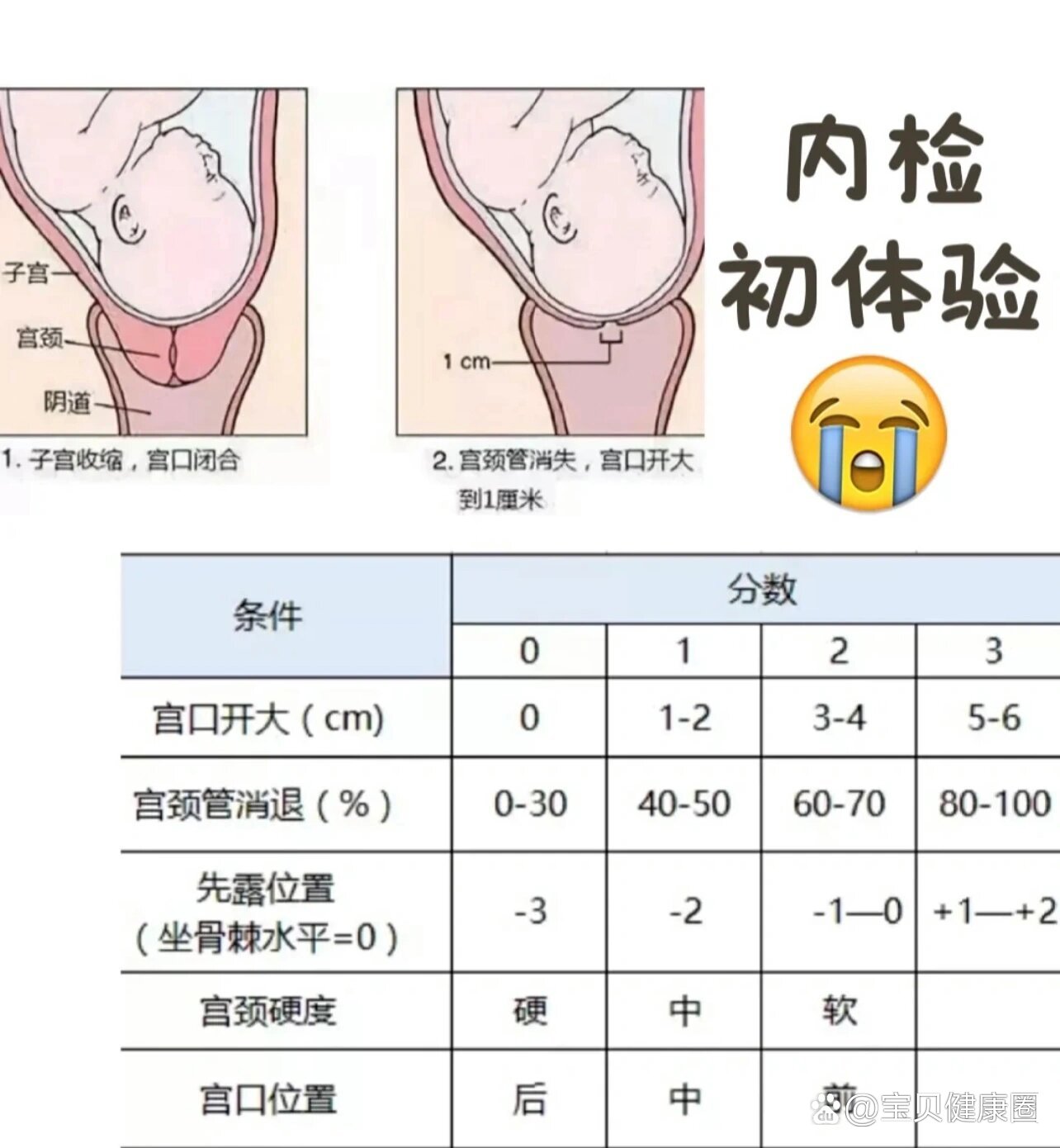 顺产后宫颈图片形状图片