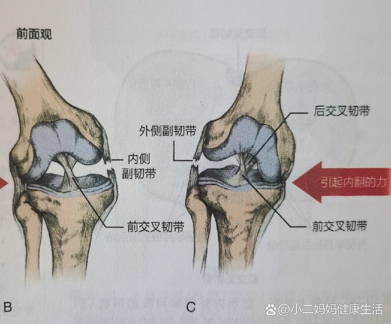 膝关节外侧副韧带位置图片