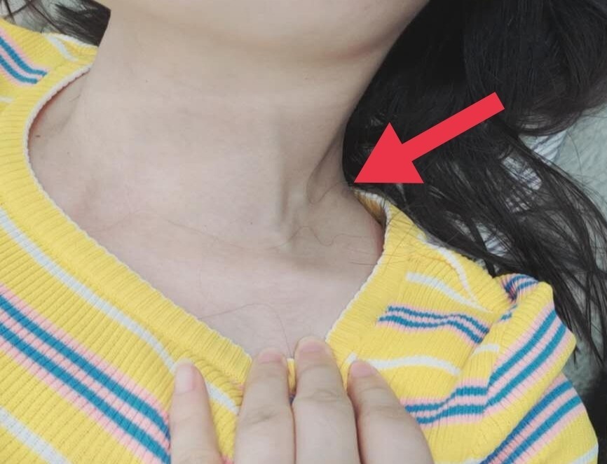 躺下时脖子上血管超级突出