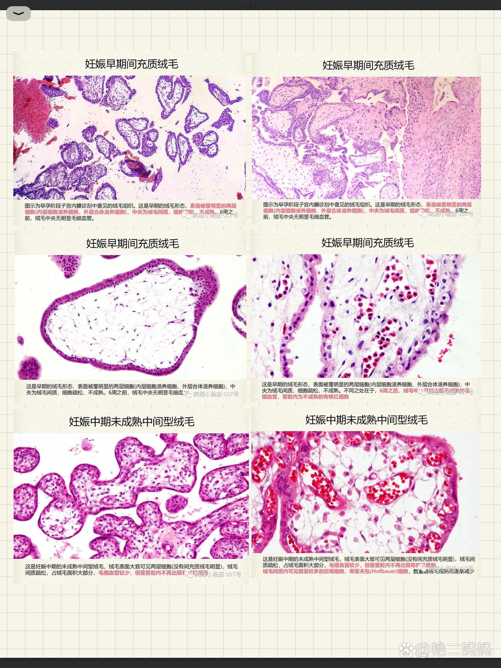 病理笔记|镜下正常组织结构(胎盘)