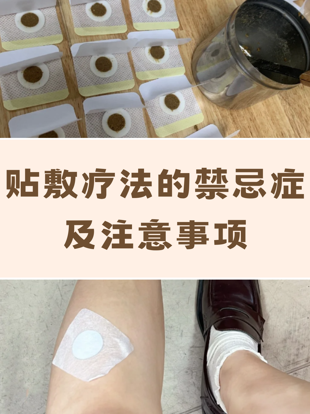 请牢记!贴敷疗法的禁忌症及注意事项