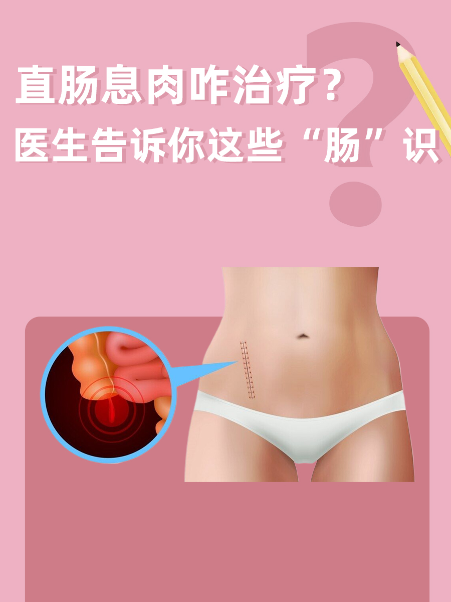 直肠息肉咋治疗?医生告诉你这些"肠"识