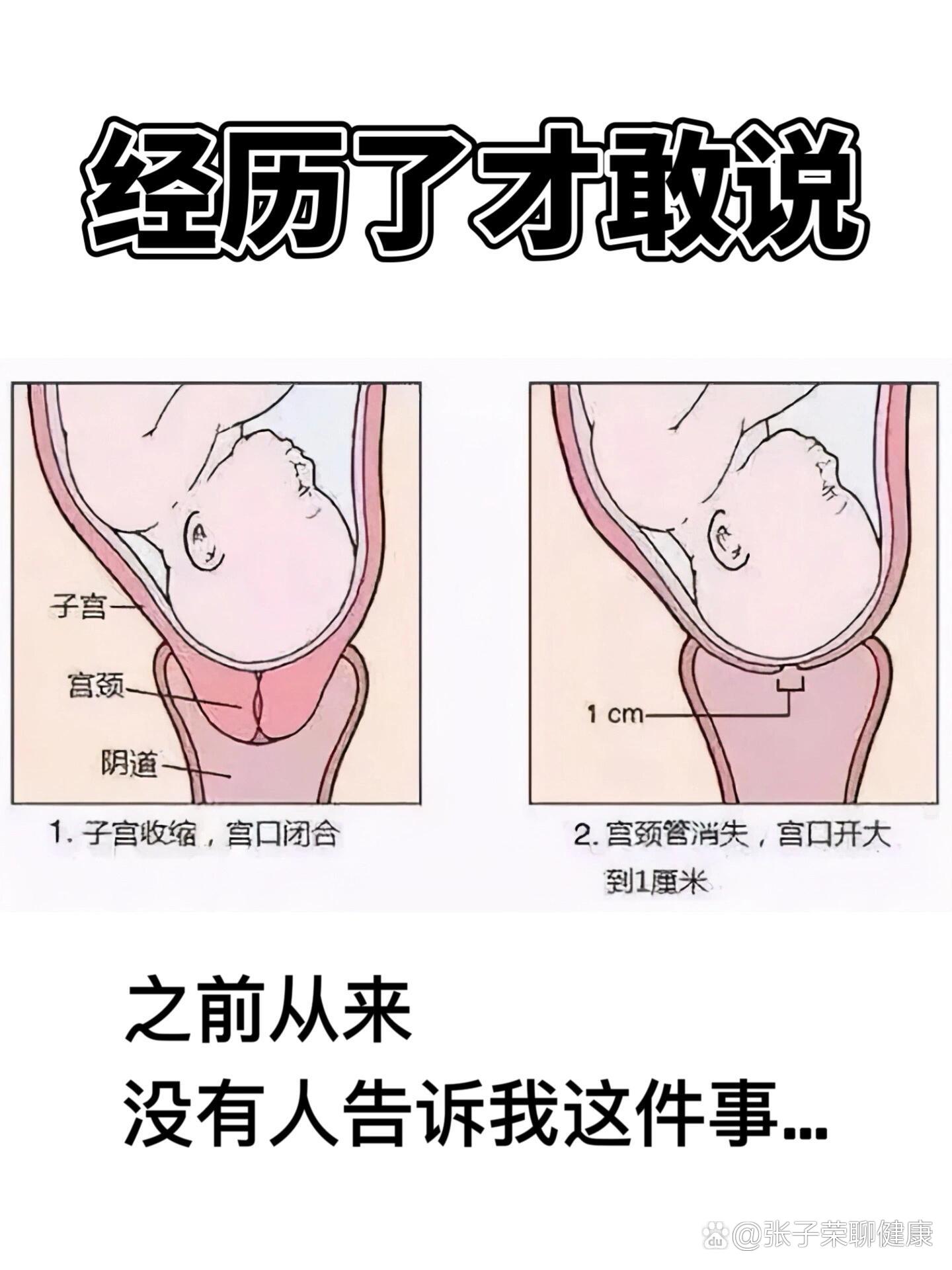 宫颈长度图片图片