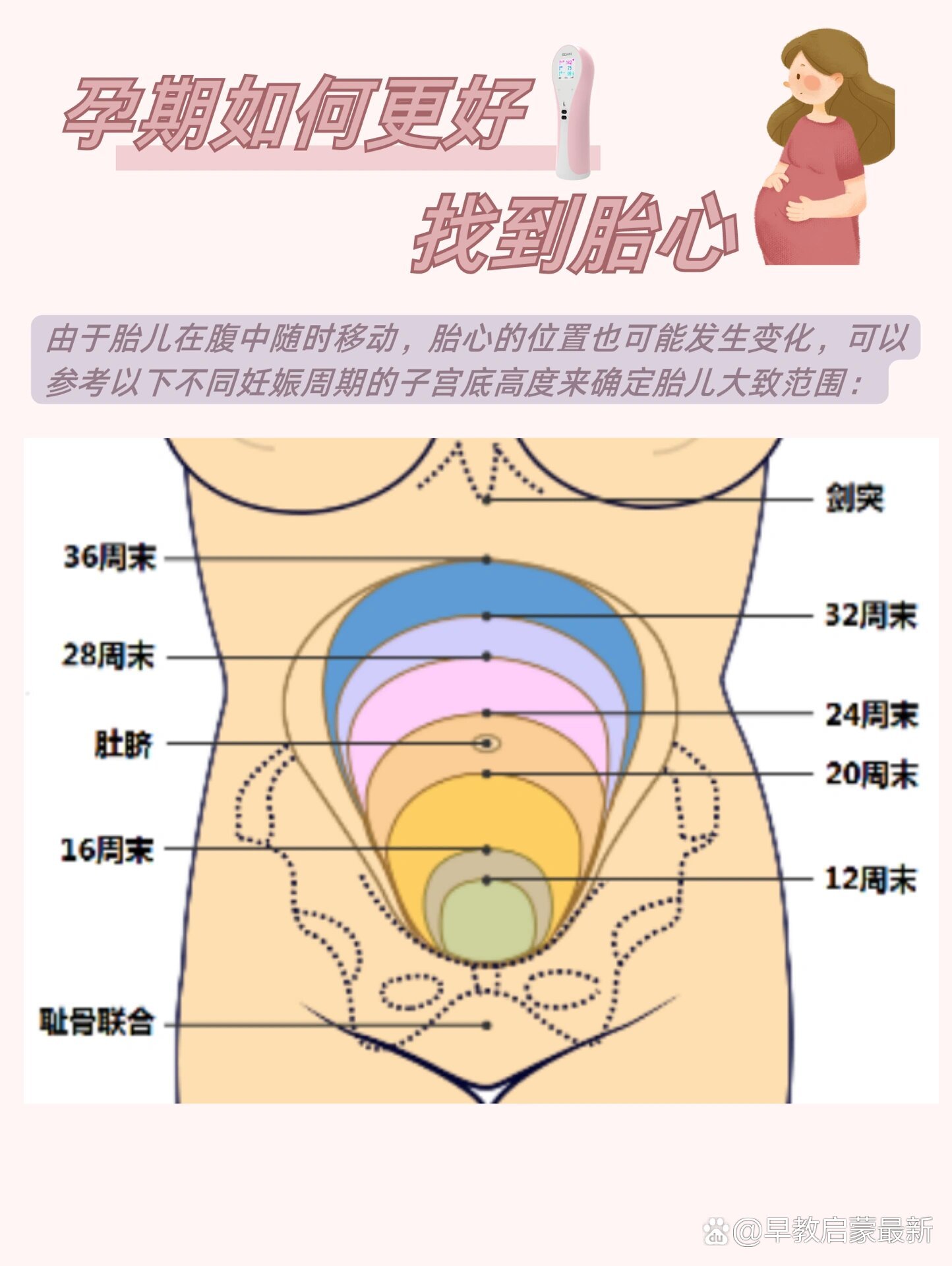 胎心位置与胎位图解图片