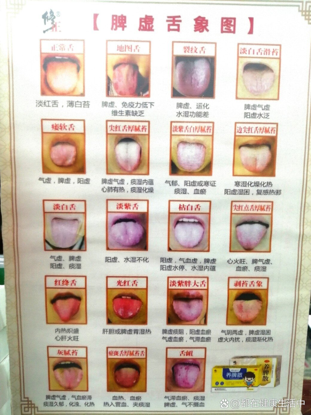 为什么脾虚湿气重为什么在线 为什么脾虚湿气重为什么在线