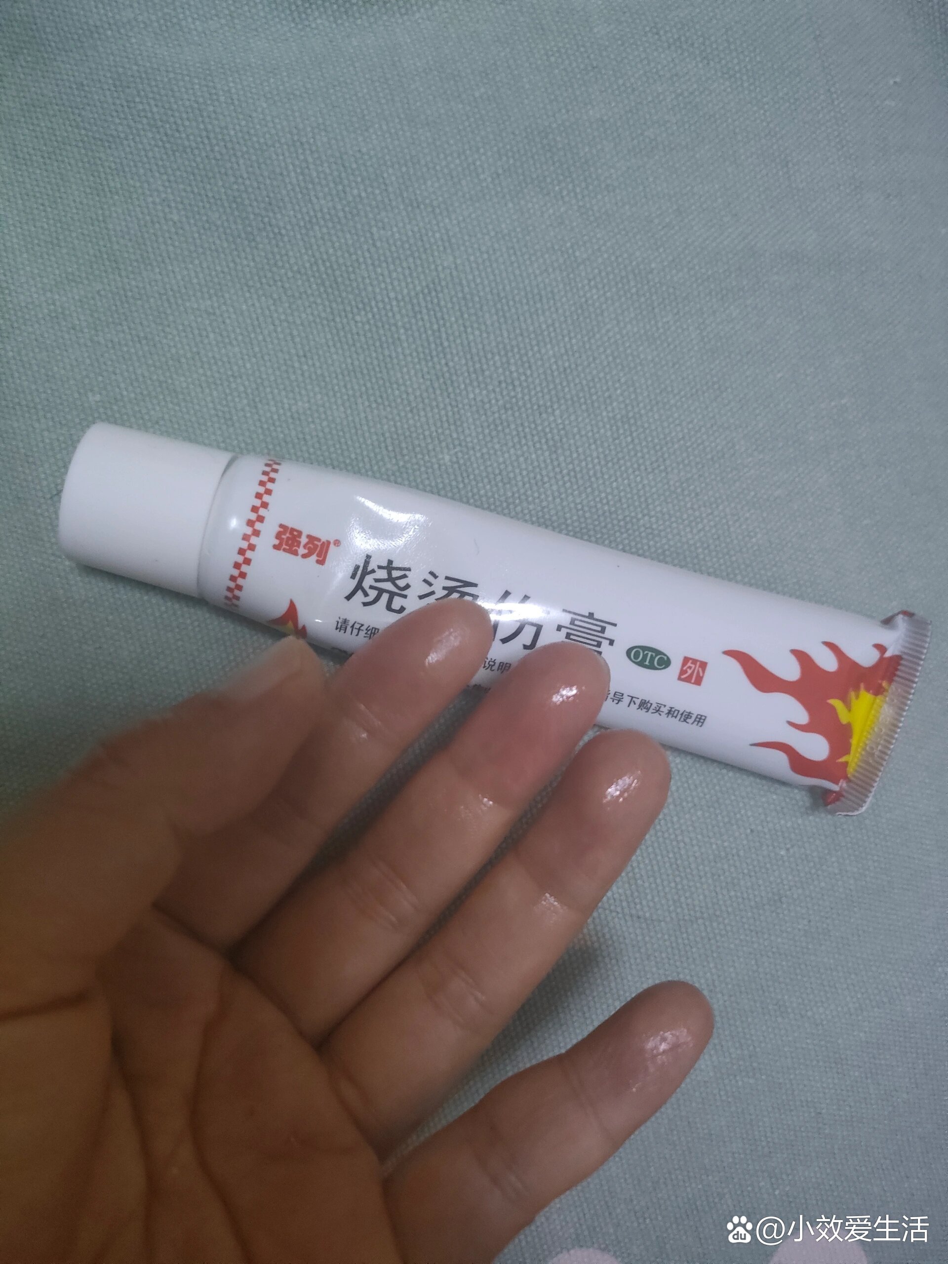 强烈推荐烫伤药膏止痛效果特别好