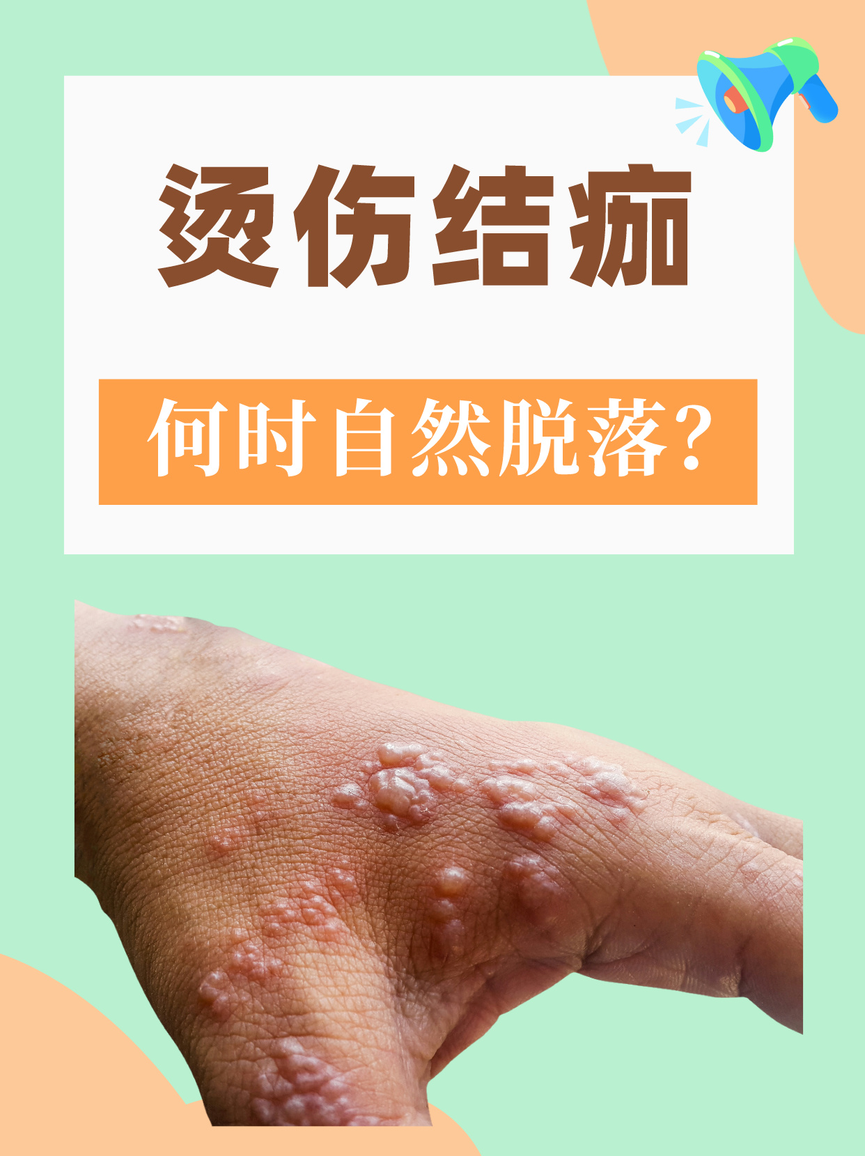 红药水结痂特别快为什么