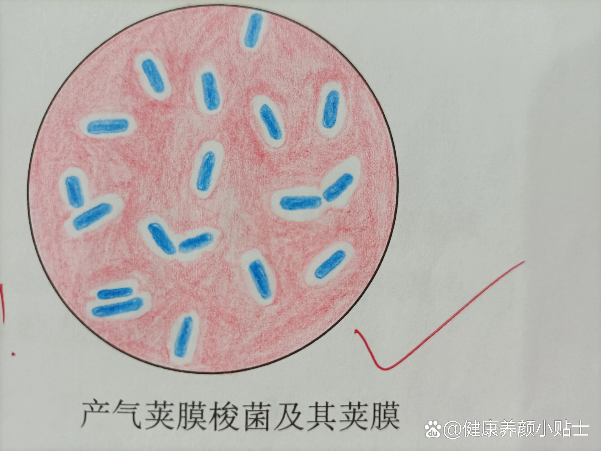 变形杆菌红蓝铅笔图图片