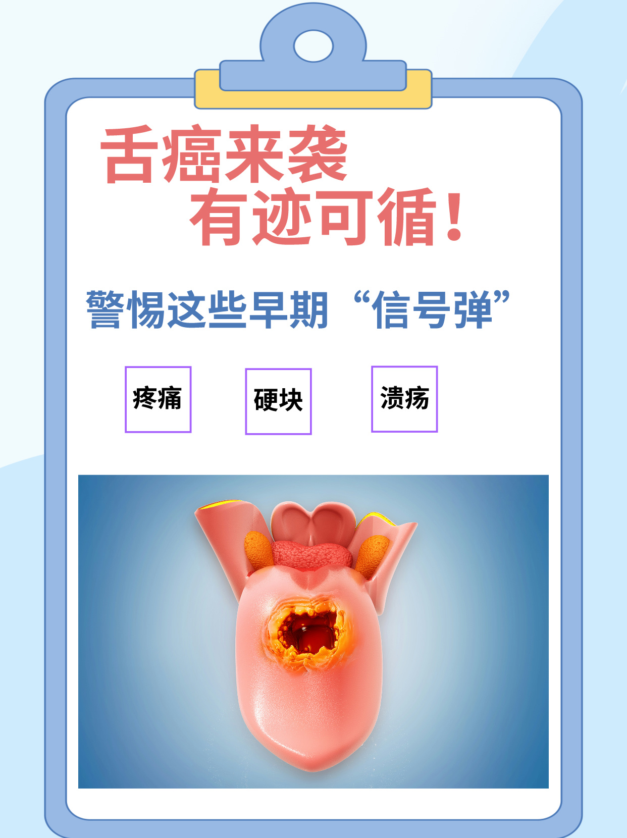 舌癌来袭有迹可循!警惕这些早期"信号弹"