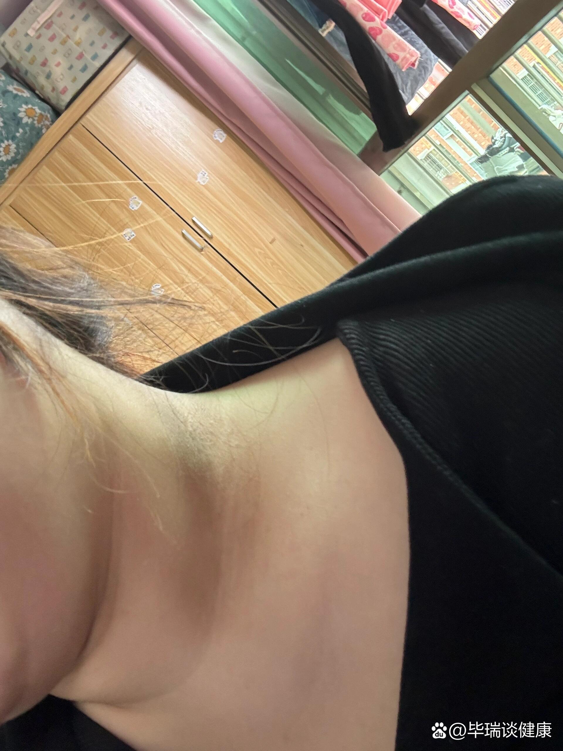 脖子上有这样黑色的胖妹妹们注意了7215