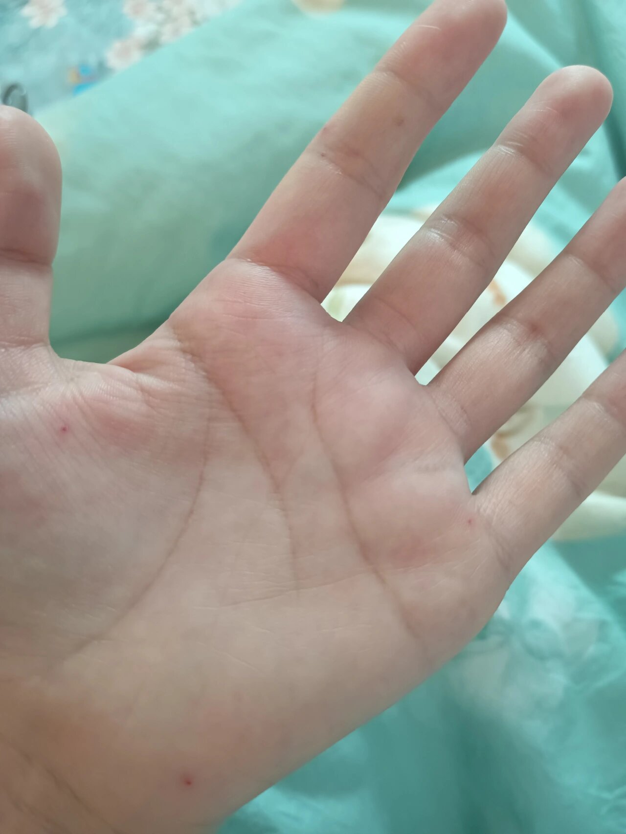 手掌上长了很多个小红点,有的变大变红了