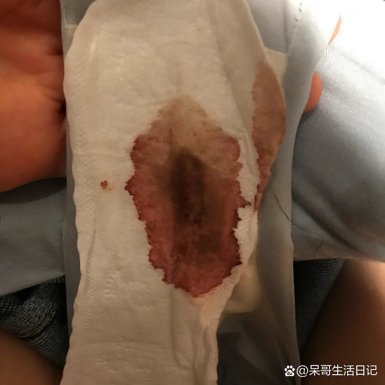 医院  br>	  br>因为下面出血,不能做阴超,所以憋尿半个小时做腹部b超