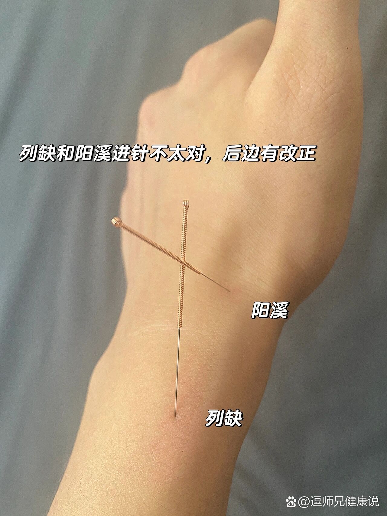 自学针灸练习列缺阳溪