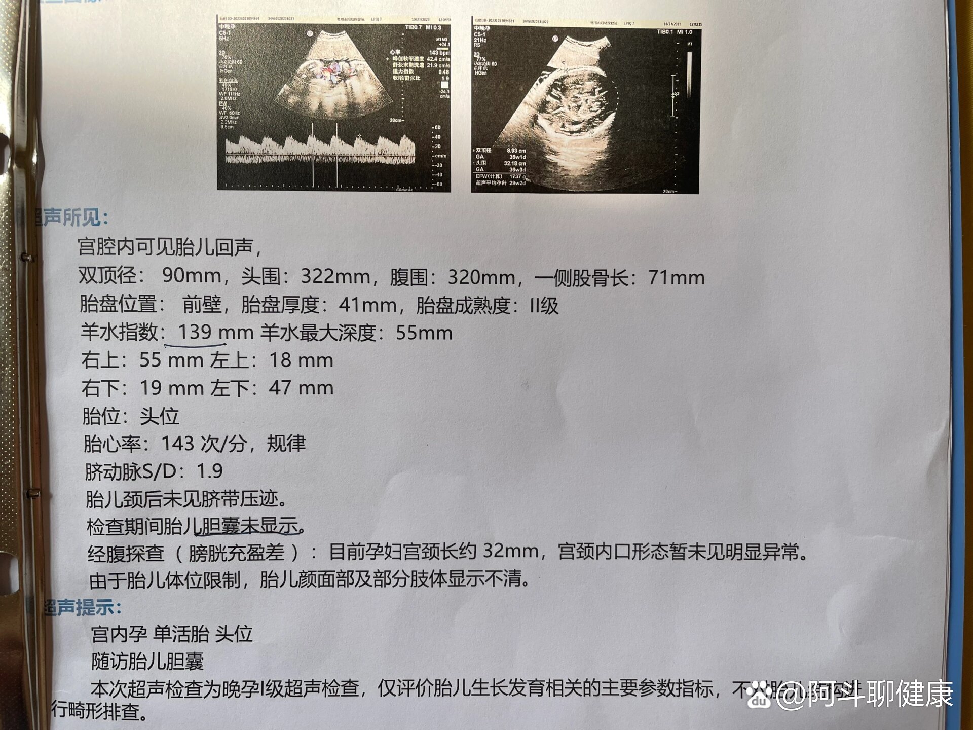 怀孕三十五天彩超图片图片