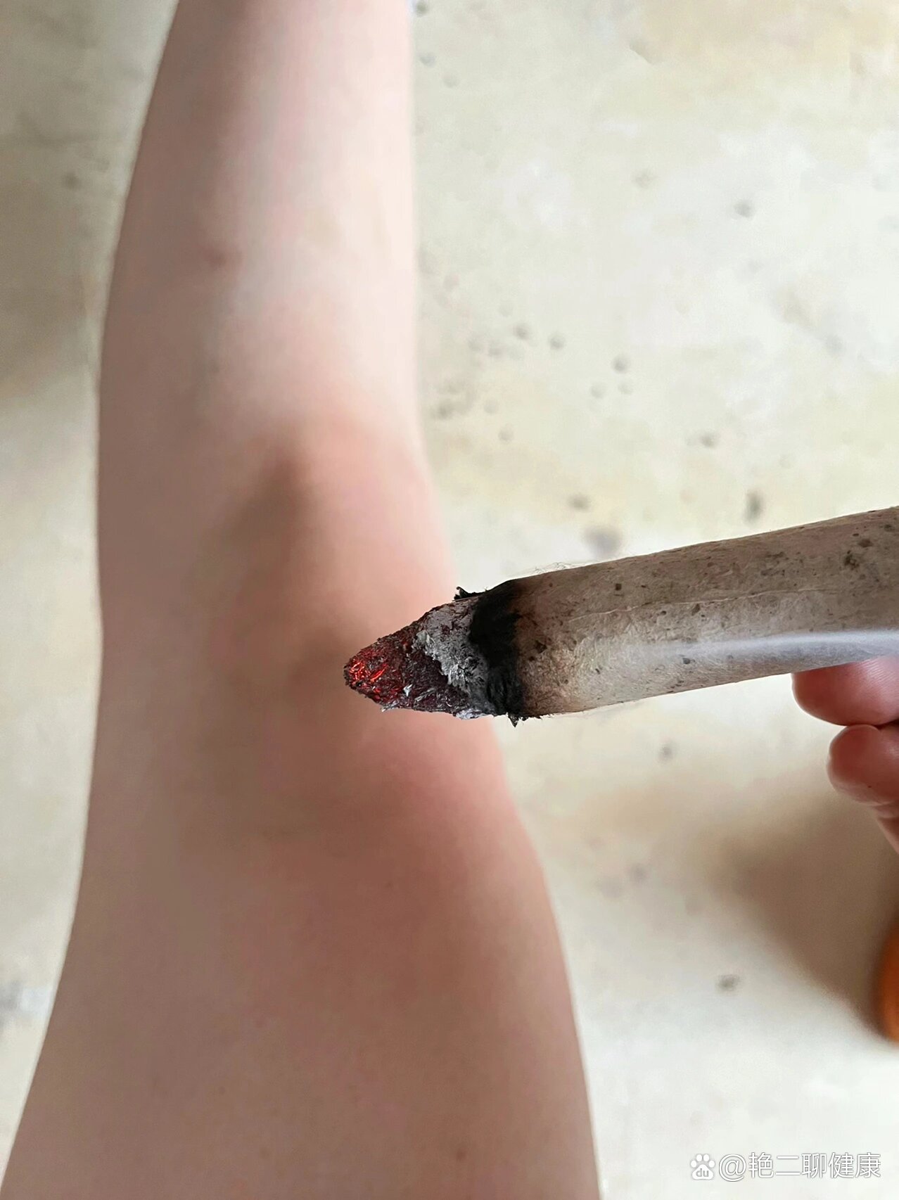 膝盖酸痛艾灸一下就好了