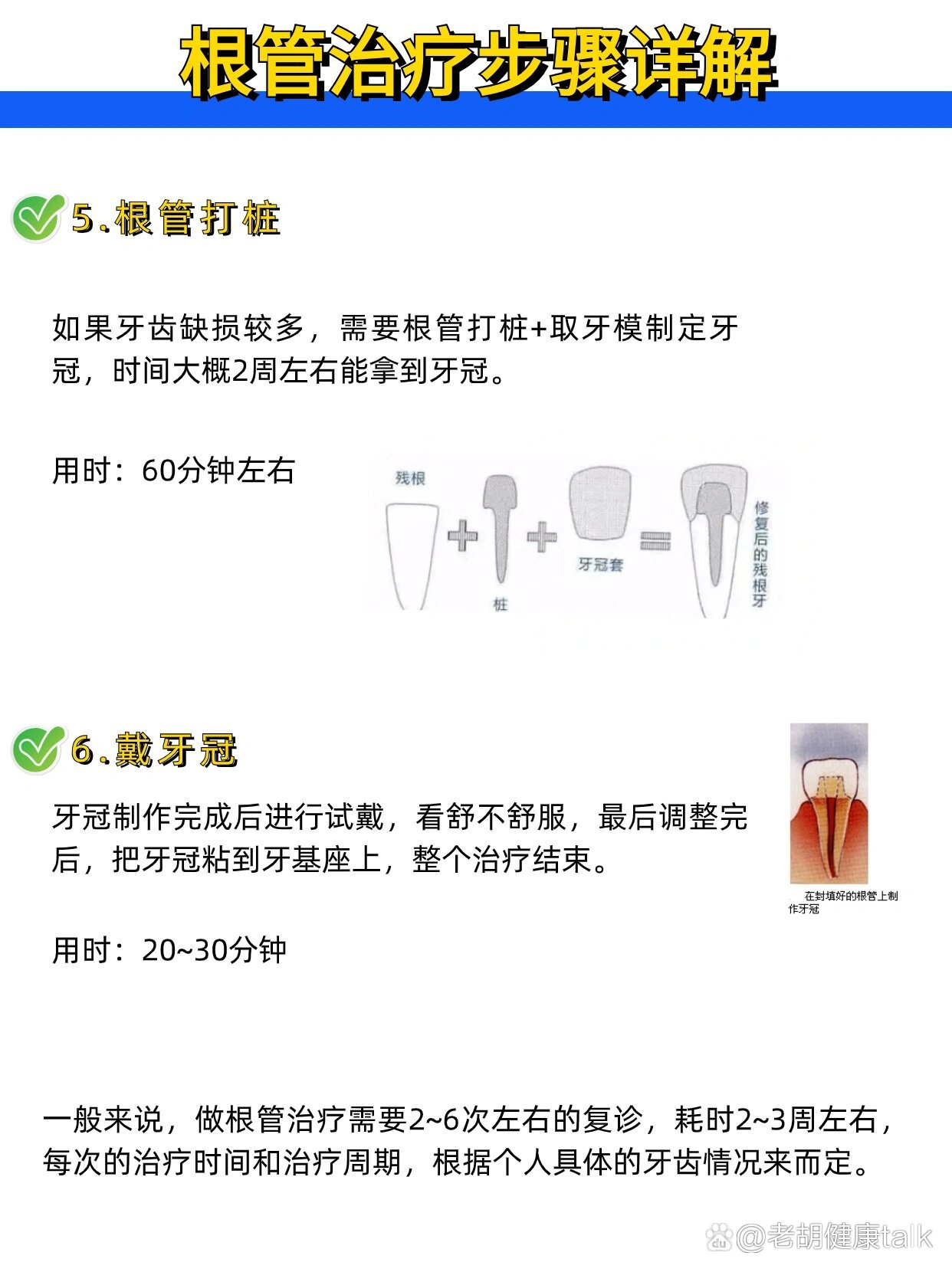 根管治疗详细步骤,看完就知道怎么做!