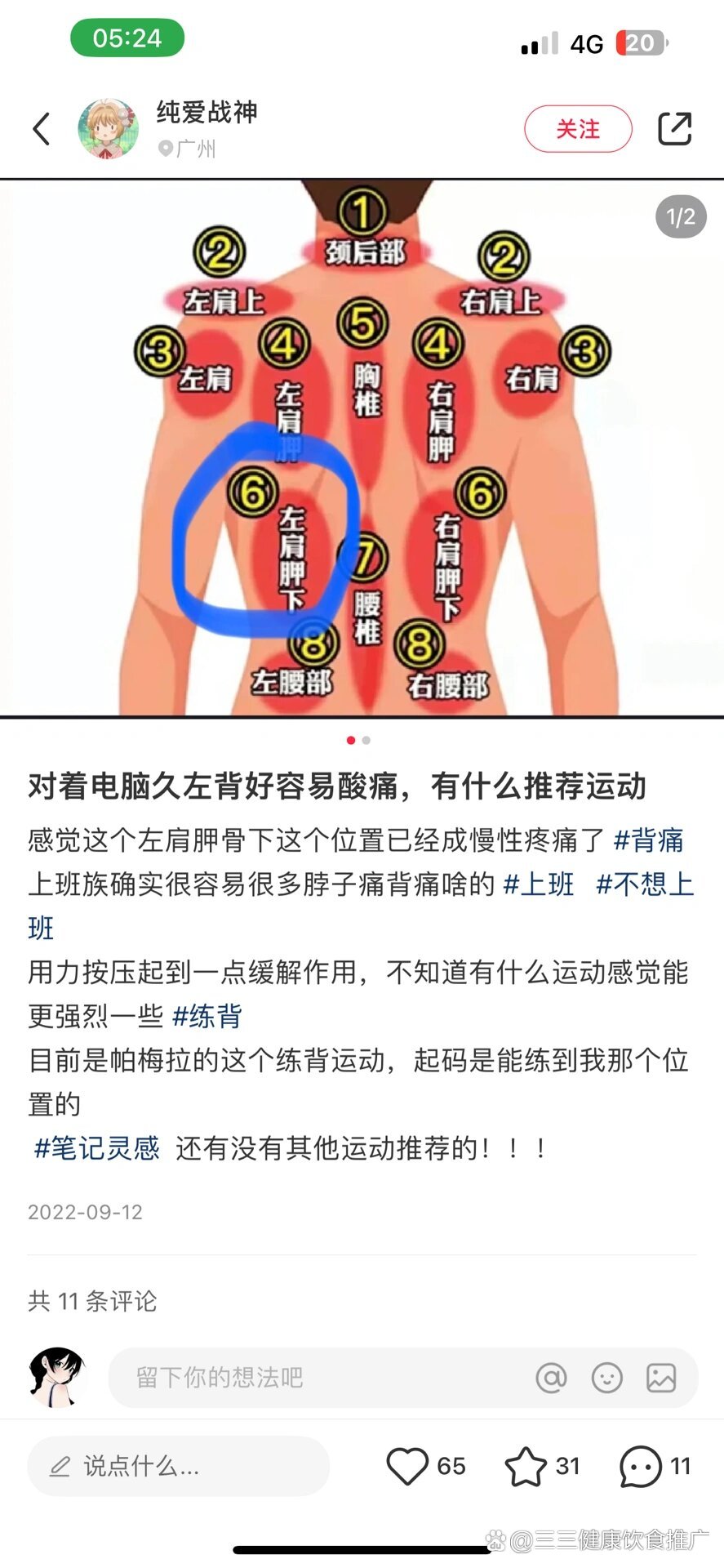 左肩胛骨下疼怎么缓解