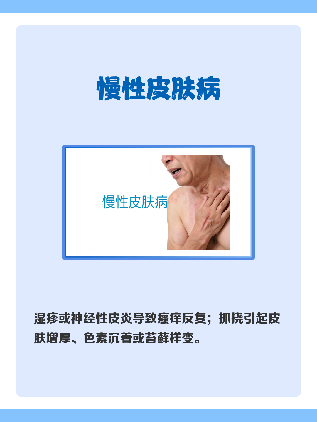 脚背痒是什么原因.越抓越痒 | 百度健康·医学科普