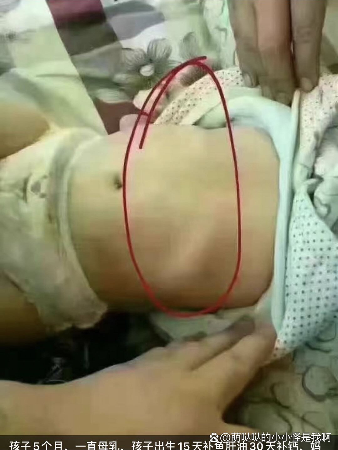 很多母婴店,或者卖宝宝用品的人都会拿着肋骨外翻来决定宝宝缺不缺钙