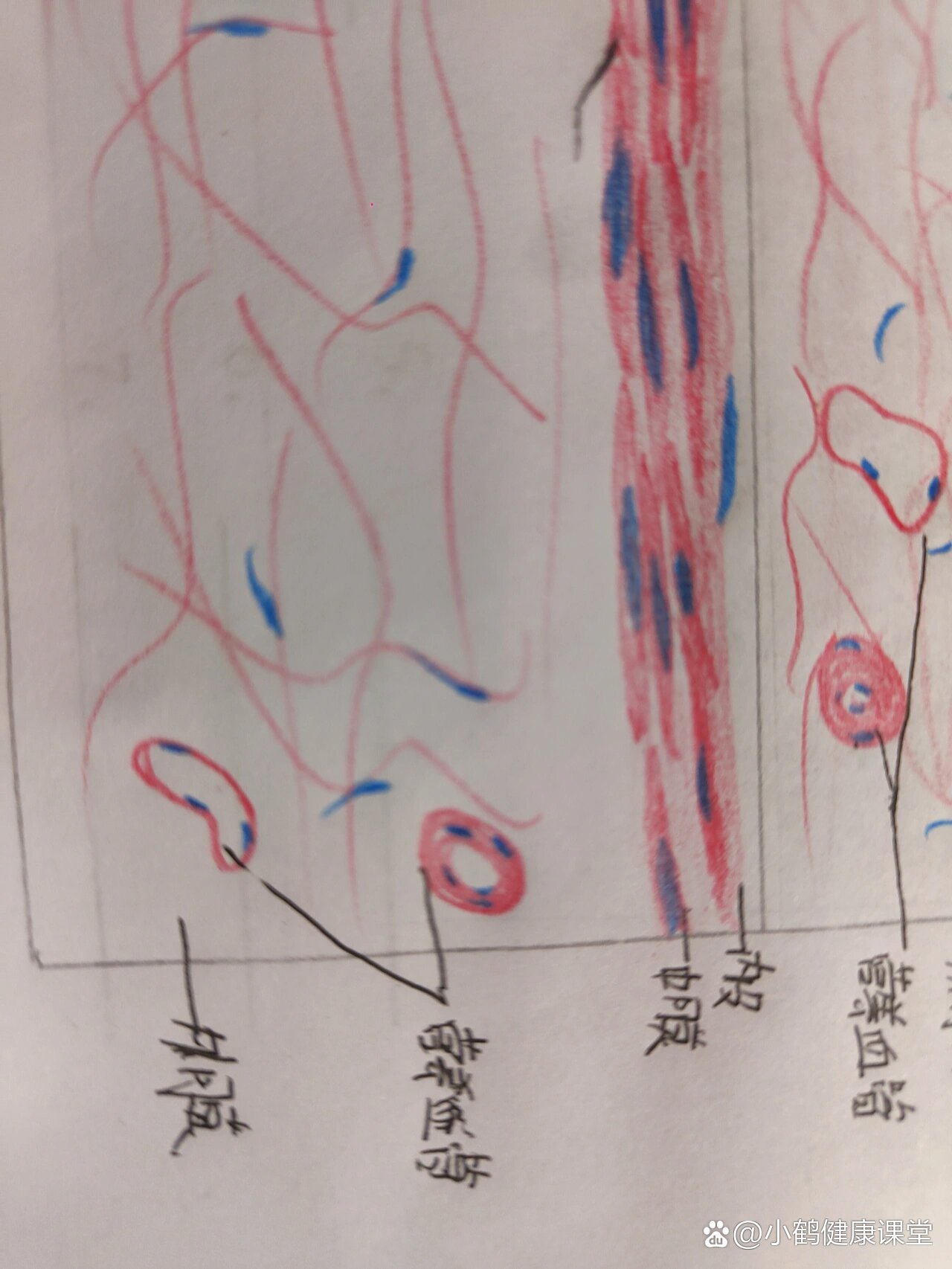 动脉粥样硬化红蓝铅笔图片