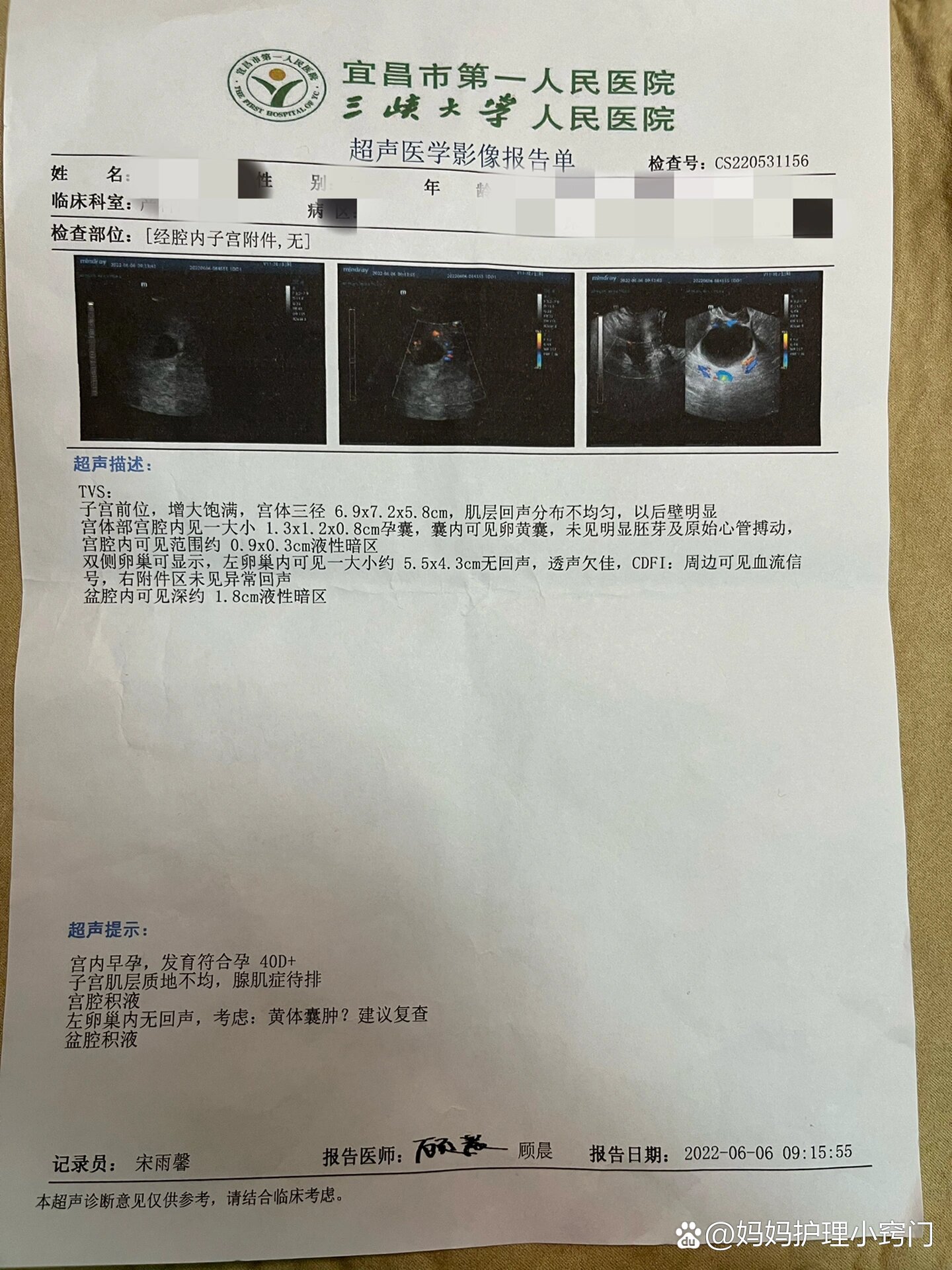 孕6周,第一次阴超
