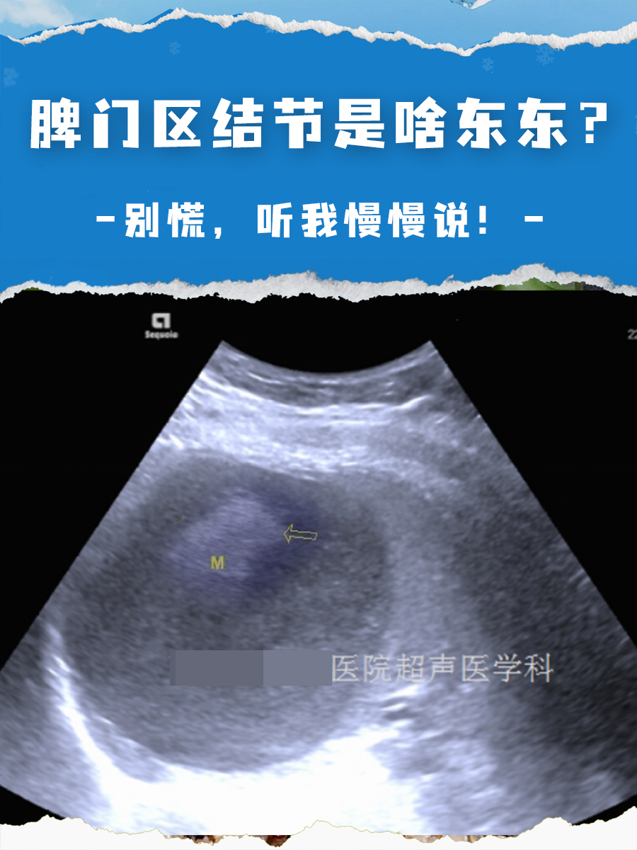 脾门区结节是啥东东?别慌,听我慢慢说!