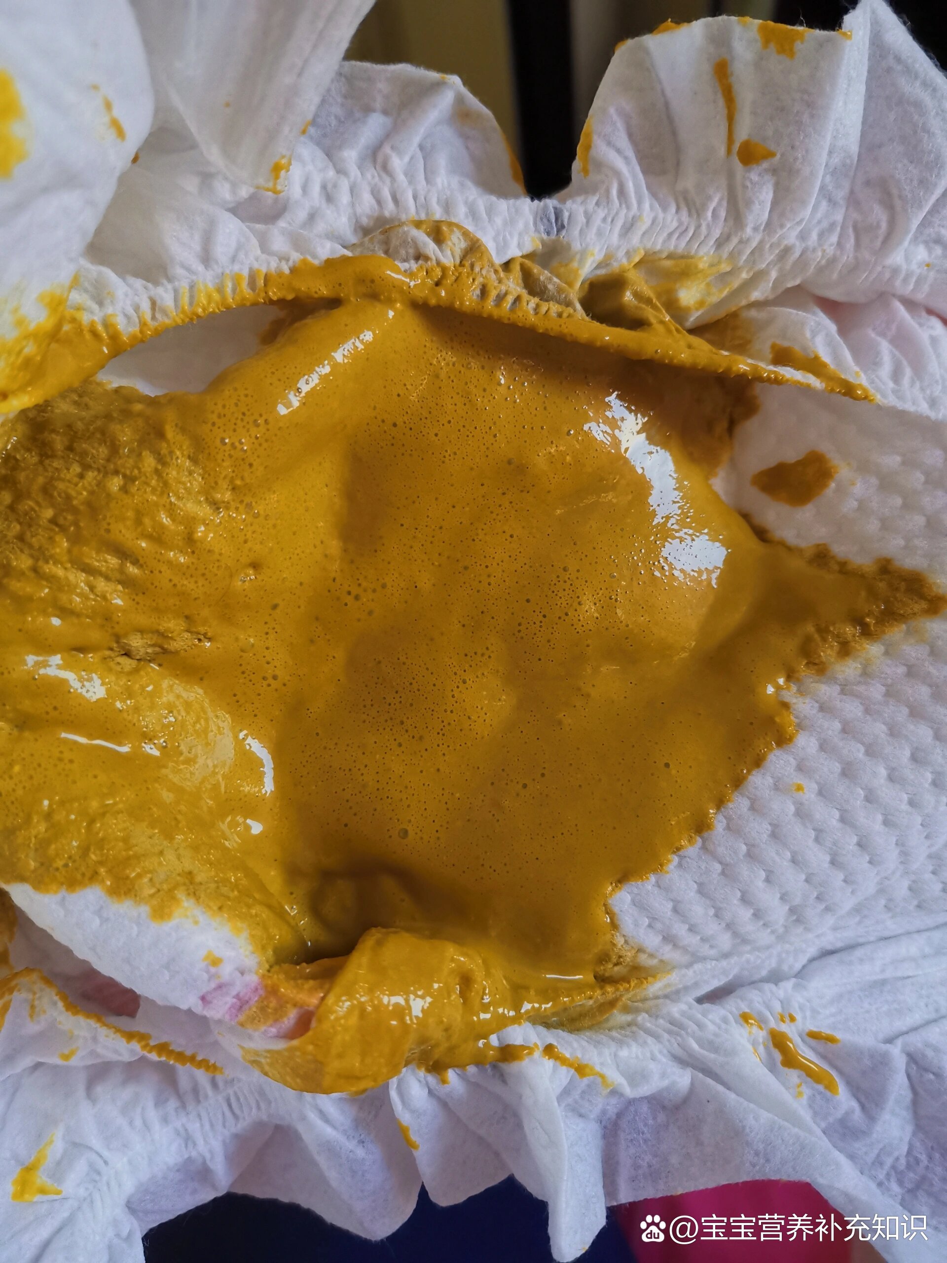 奶粉宝宝突然出现泡沫便