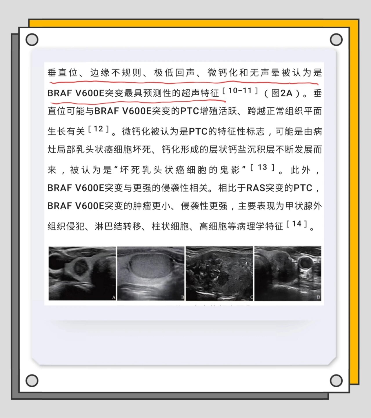 超声判断甲状腺癌类型的指征