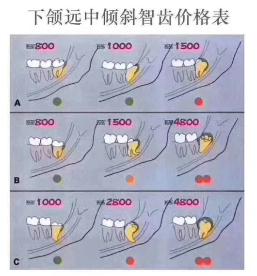 多生牙拔牙多少钱图片