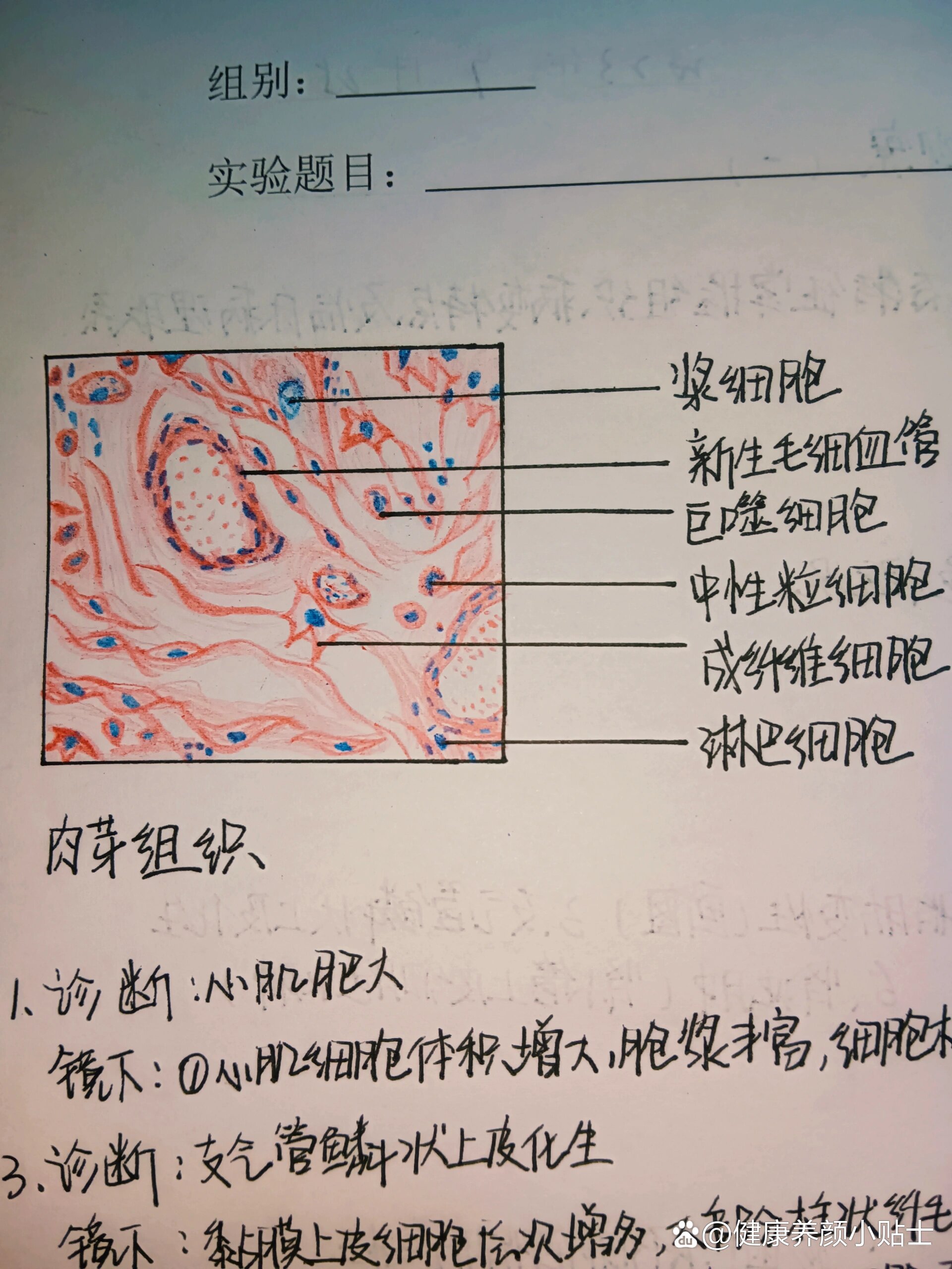 肉芽组织手绘图片