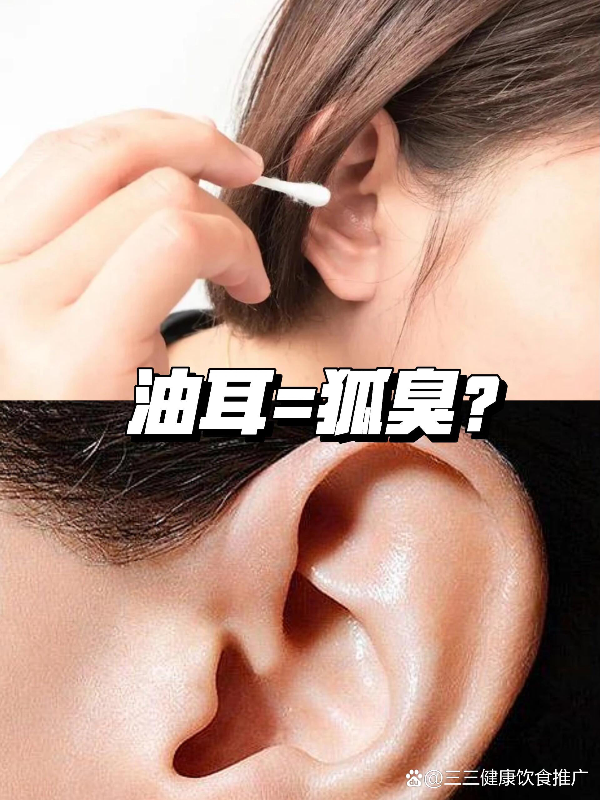 你知道狐臭和油耳的关系吗?